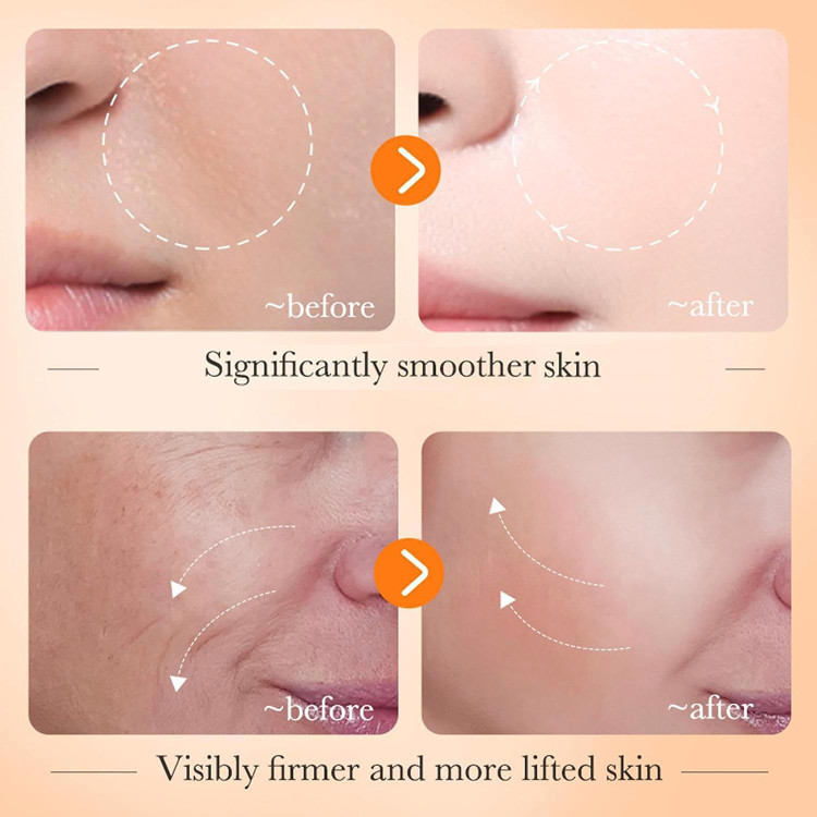 سرم روشن کننده ویتامین C اورجینال (آنتی اکسیدان)